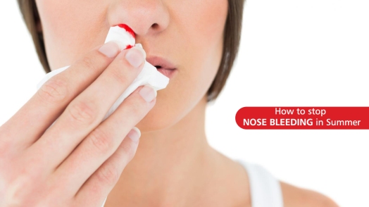 nose bleeding,how to stop nose bleeds,what causes nose bleeds,nose bleeds in children,how to prevent nosebleeds,reasons fo nose bleeding,nosebleeds in children when to worry,nose bleeds everyday